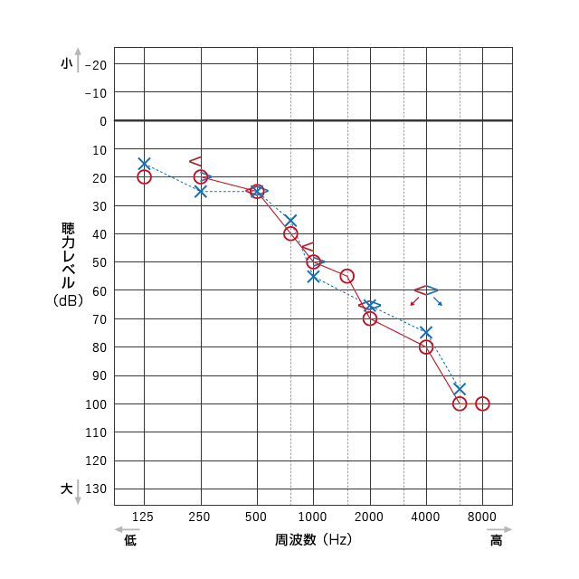 図解:純音聴力検査(気導聴力検査と骨導聴力検査)で測定した聴力結果のグラフをオージオグラムという