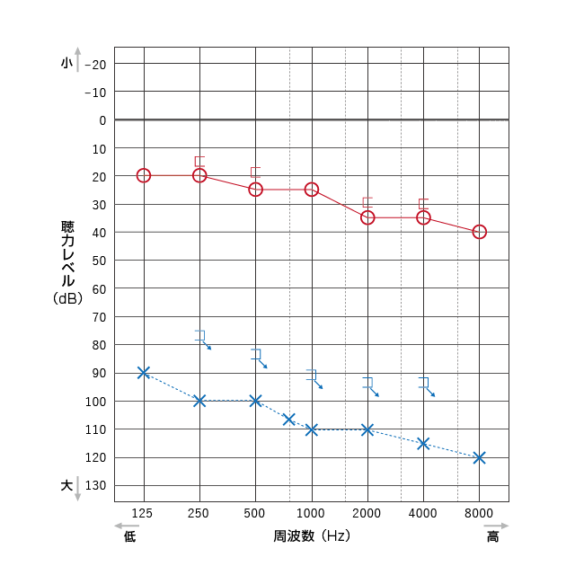 オージオグラムに矢印が付いている箇所はスケールアウト