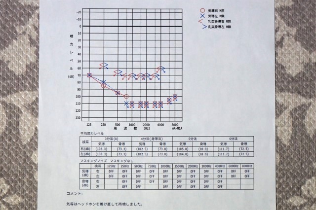 純音聴力検査を受けた筆者の検査結果グラフ・オージオグラム